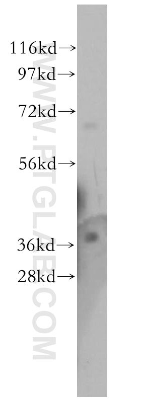 Western Blot (WB) analysis of HeLa cells using TMOD4 Polyclonal antibody (11753-1-AP)