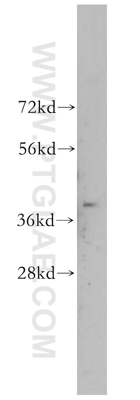 Western Blot (WB) analysis of human brain tissue using TMOD4 Polyclonal antibody (11753-1-AP)