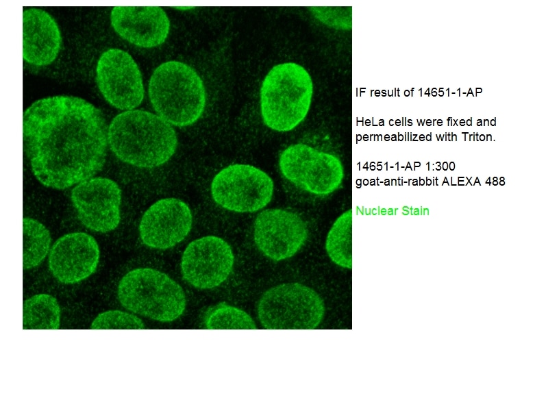 Immunofluorescence (IF) / fluorescent staining of HeLa cells using TMPO/LAP2 Polyclonal antibody (14651-1-AP)