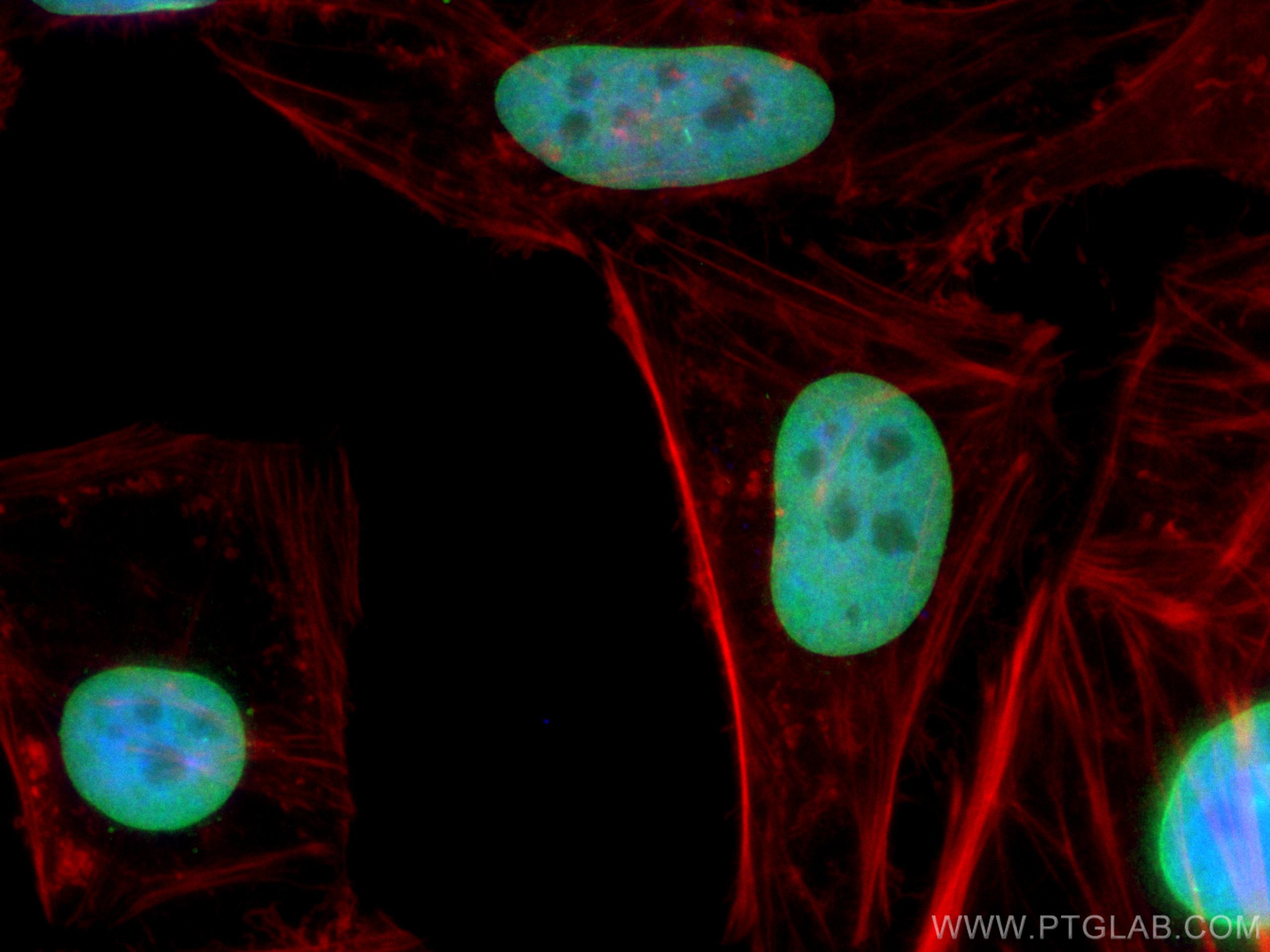 Immunofluorescence (IF) / fluorescent staining of HeLa cells using TMPO/LAP2 Polyclonal antibody (14651-1-AP)