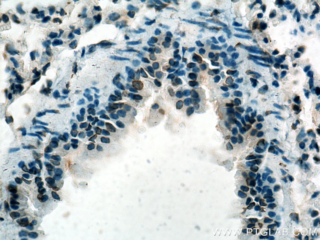 Immunohistochemistry (IHC) staining of mouse lung tissue using TMPO/LAP2 Polyclonal antibody (14651-1-AP)