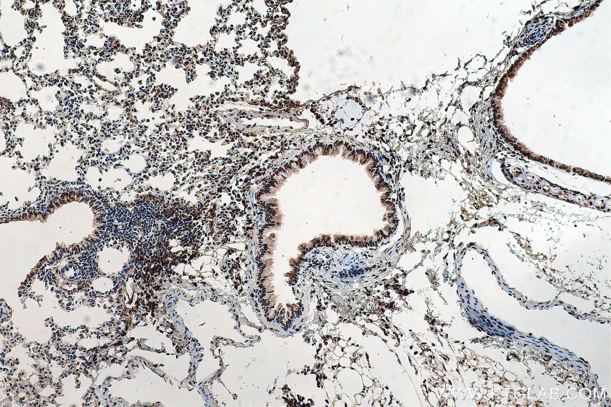 IHC staining of mouse lung using 14651-1-AP
