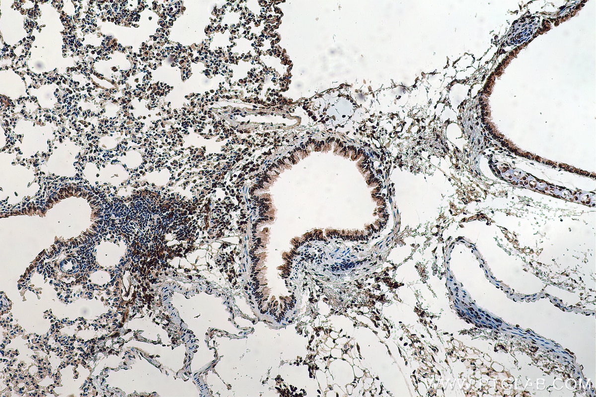 Immunohistochemistry (IHC) staining of mouse lung tissue using TMPO/LAP2 Polyclonal antibody (14651-1-AP)