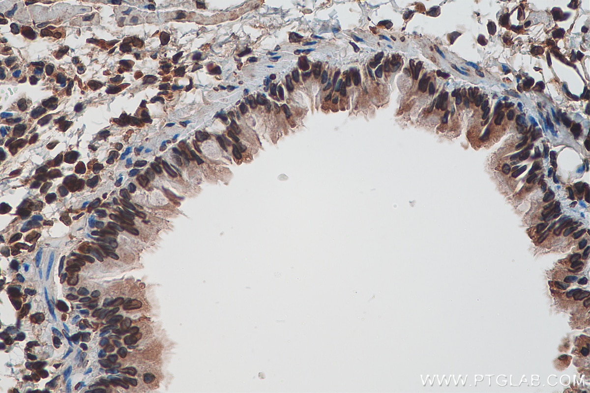 Immunohistochemistry (IHC) staining of mouse lung tissue using TMPO/LAP2 Polyclonal antibody (14651-1-AP)