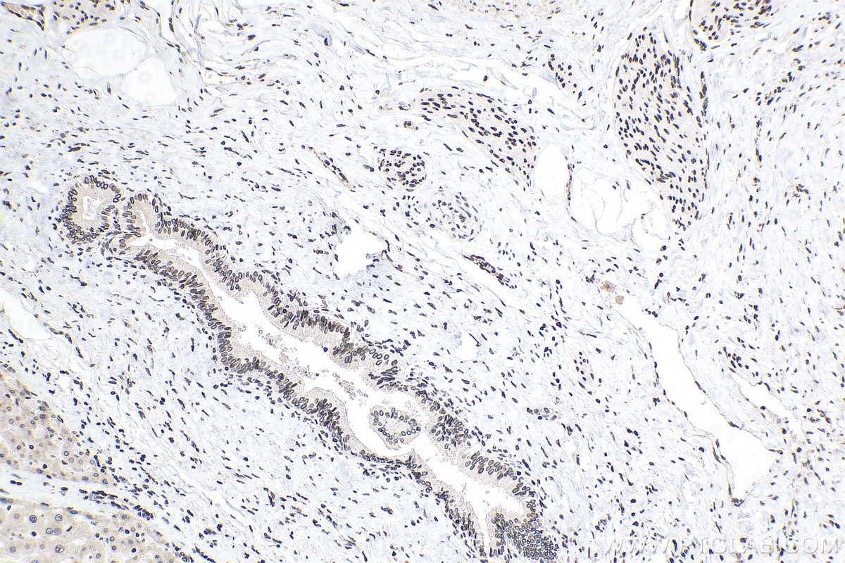 Immunohistochemistry (IHC) staining of human liver tissue using TMPO/LAP2 Polyclonal antibody (14651-1-AP)