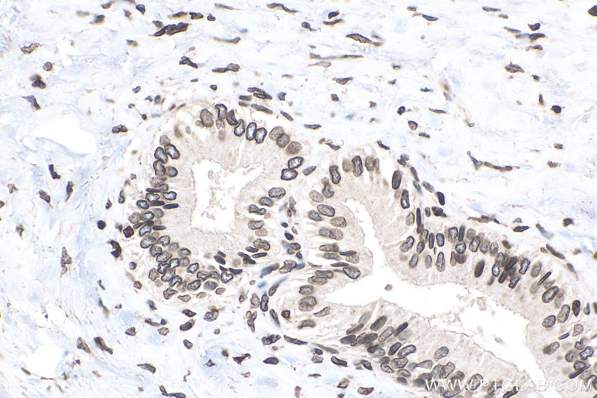 Immunohistochemistry (IHC) staining of human liver tissue using TMPO/LAP2 Polyclonal antibody (14651-1-AP)