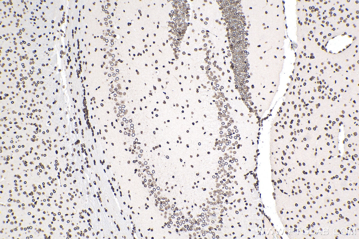 IHC staining of mouse brain using 14651-1-AP