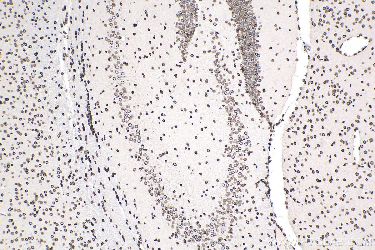 Immunohistochemistry (IHC) staining of mouse brain tissue using TMPO/LAP2 Polyclonal antibody (14651-1-AP)