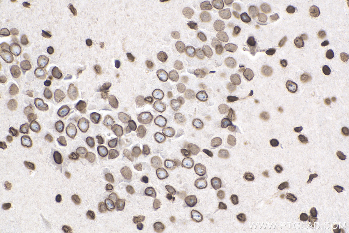 Immunohistochemistry (IHC) staining of mouse brain tissue using TMPO/LAP2 Polyclonal antibody (14651-1-AP)