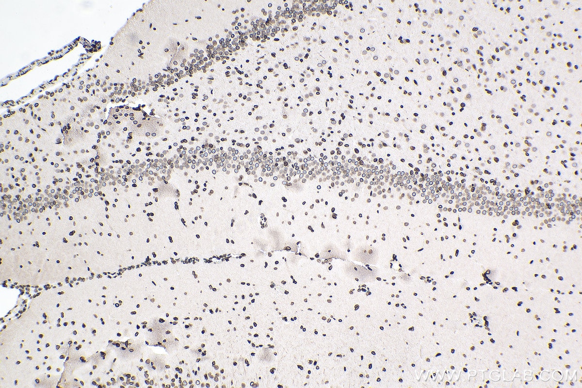Immunohistochemistry (IHC) staining of rat brain tissue using TMPO/LAP2 Polyclonal antibody (14651-1-AP)
