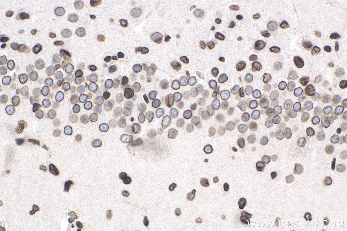 Immunohistochemistry (IHC) staining of rat brain tissue using TMPO/LAP2 Polyclonal antibody (14651-1-AP)