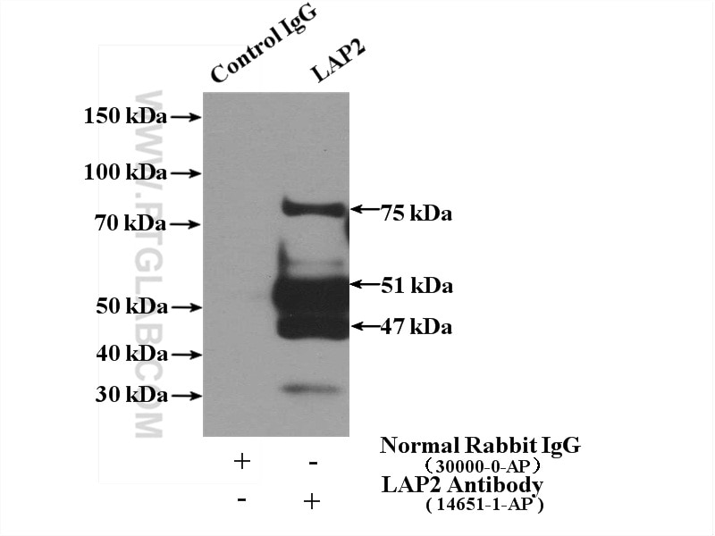 Immunoprecipitation (IP) experiment of HeLa cells using TMPO/LAP2 Polyclonal antibody (14651-1-AP)