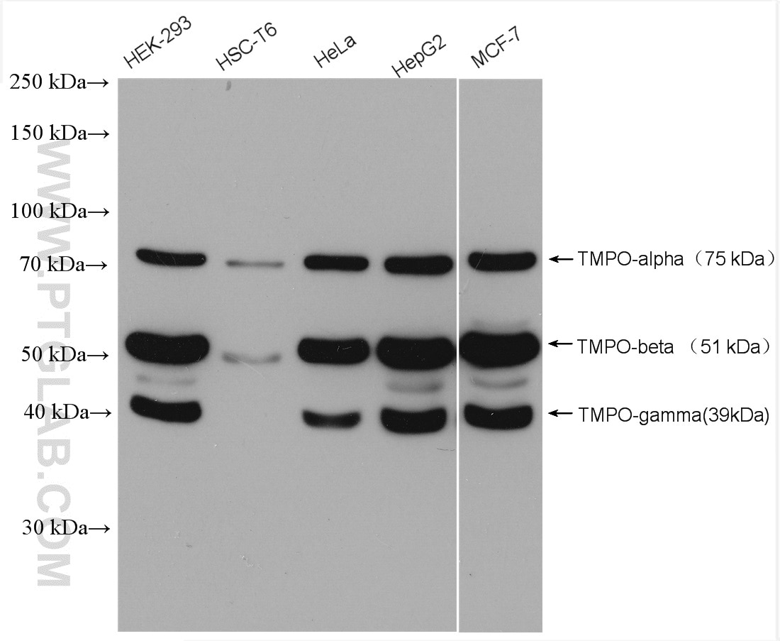 Western Blot (WB) analysis of various lysates using TMPO/LAP2 Polyclonal antibody (14651-1-AP)