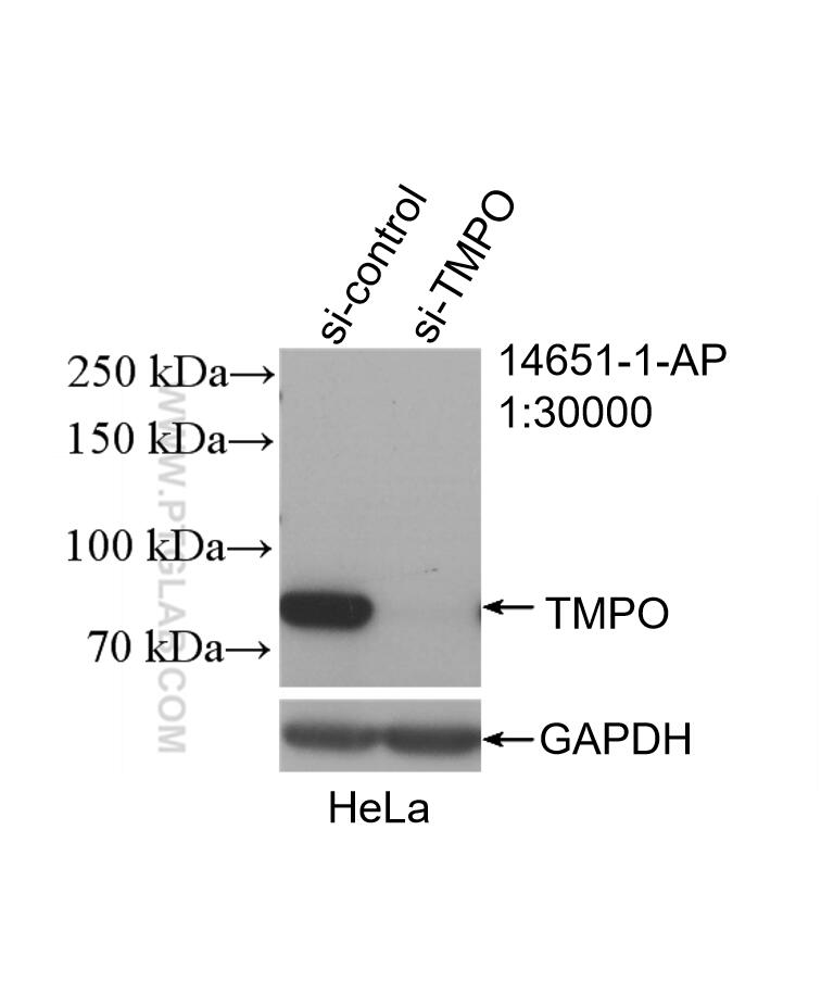 Western Blot (WB) analysis of HeLa cells using TMPO/LAP2 Polyclonal antibody (14651-1-AP)