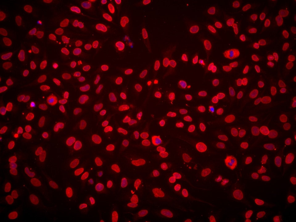 Immunofluorescence (IF) / fluorescent staining of HeLa cells using TMPO/LAP2 Monoclonal antibody (67157-1-Ig)