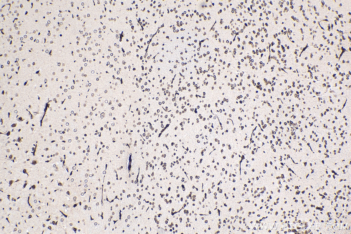 Immunohistochemistry (IHC) staining of mouse brain tissue using TMPO/LAP2 Monoclonal antibody (67157-1-Ig)