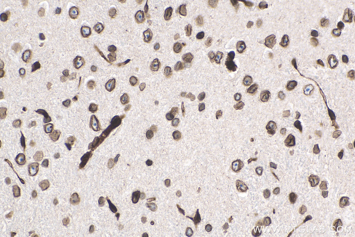 Immunohistochemistry (IHC) staining of mouse brain tissue using TMPO/LAP2 Monoclonal antibody (67157-1-Ig)