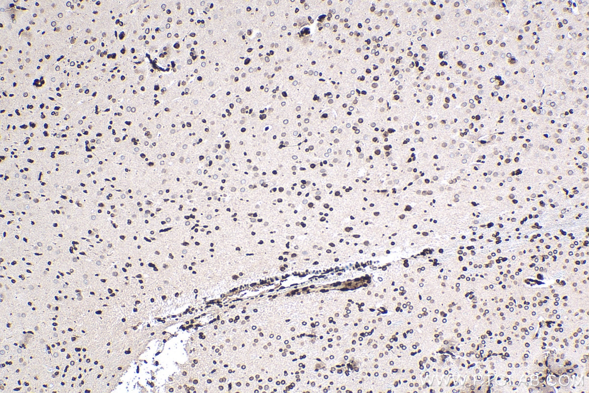 Immunohistochemistry (IHC) staining of rat brain tissue using TMPO/LAP2 Monoclonal antibody (67157-1-Ig)