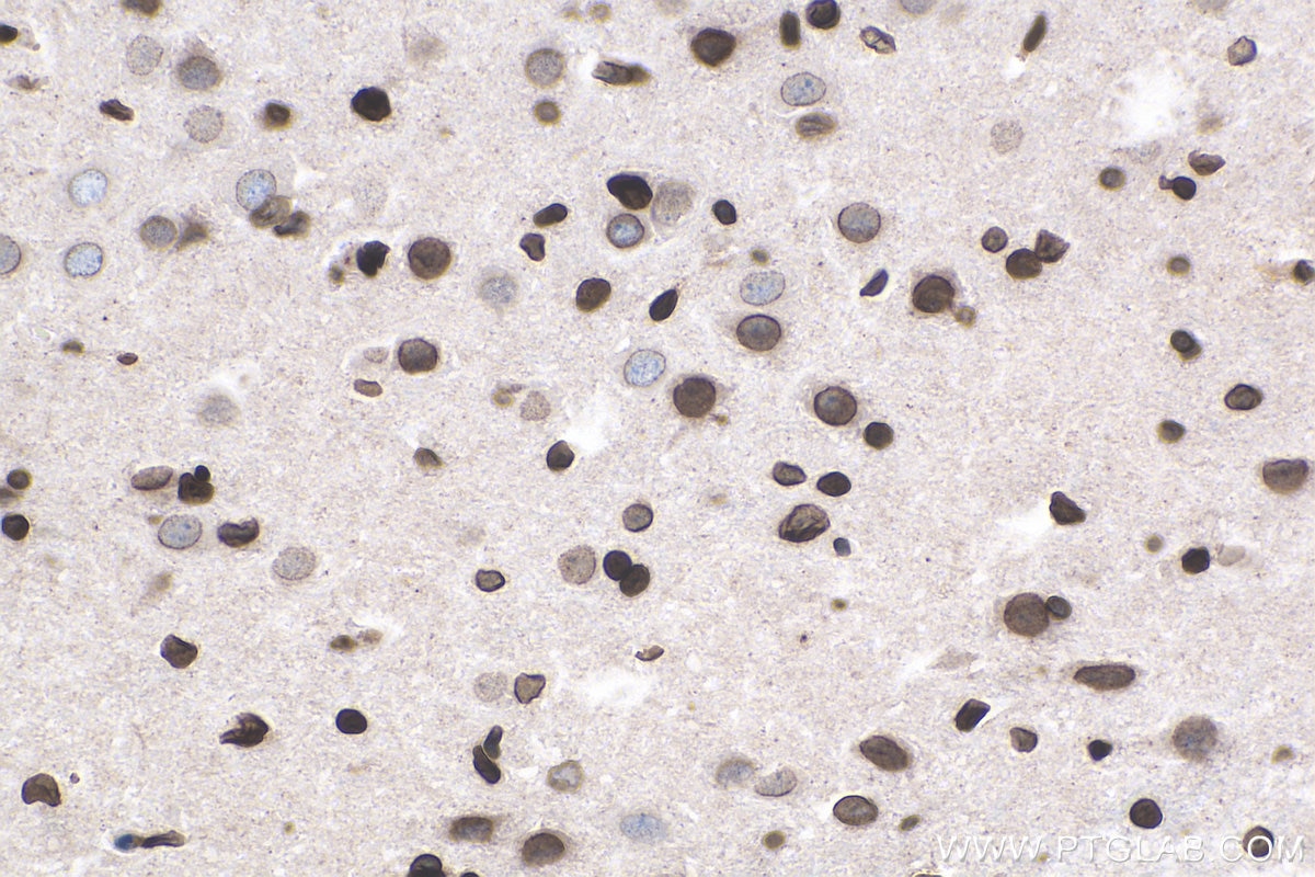 Immunohistochemistry (IHC) staining of rat brain tissue using TMPO/LAP2 Monoclonal antibody (67157-1-Ig)