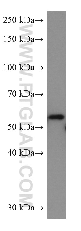 Western Blot (WB) analysis of SH-SY5Y cells using TMPO/LAP2 Monoclonal antibody (67157-1-Ig)