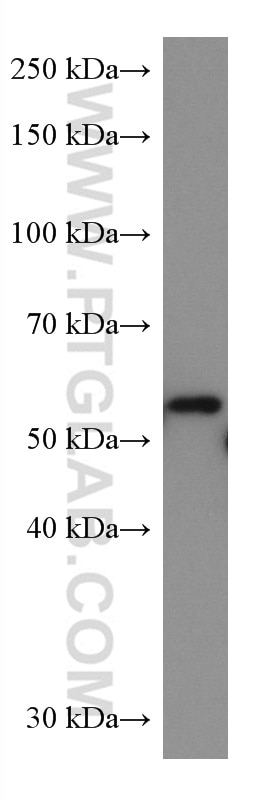 WB analysis of SH-SY5Y using 67157-1-Ig