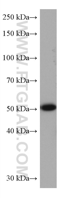 Western Blot (WB) analysis of HSC-T6 cells using TMPO/LAP2 Monoclonal antibody (67157-1-Ig)