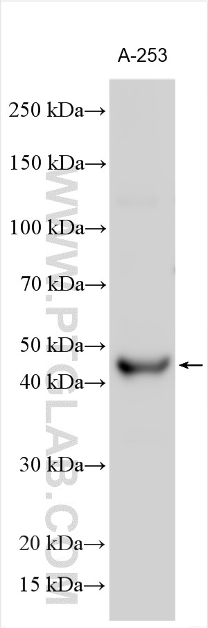 Western Blot (WB) analysis of various lysates using TMPRSS11D Polyclonal antibody (24634-1-AP)
