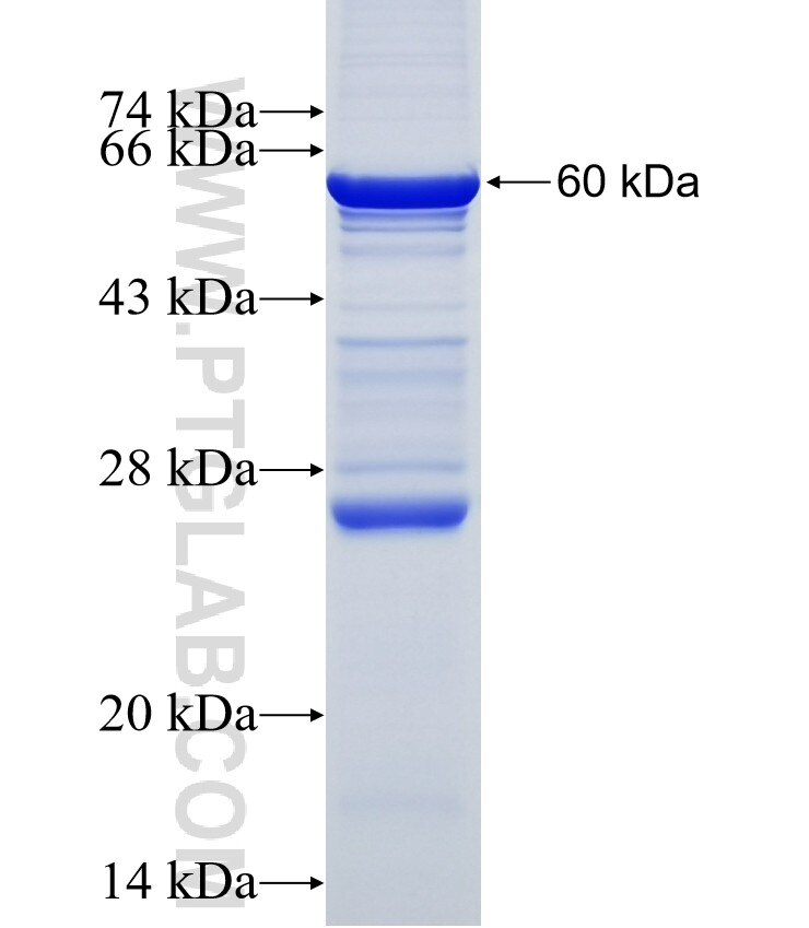 TMPRSS11D fusion protein Ag17841 SDS-PAGE TMPRSS11D fusion protein Ag17841 SDS-PAGE