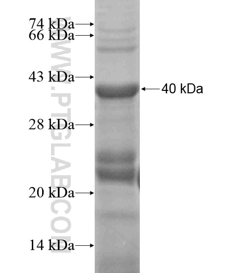 TMPRSS11D fusion protein Ag19061 SDS-PAGE