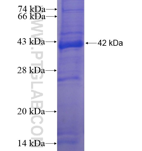 TMPRSS12 fusion protein Ag14777 SDS-PAGE