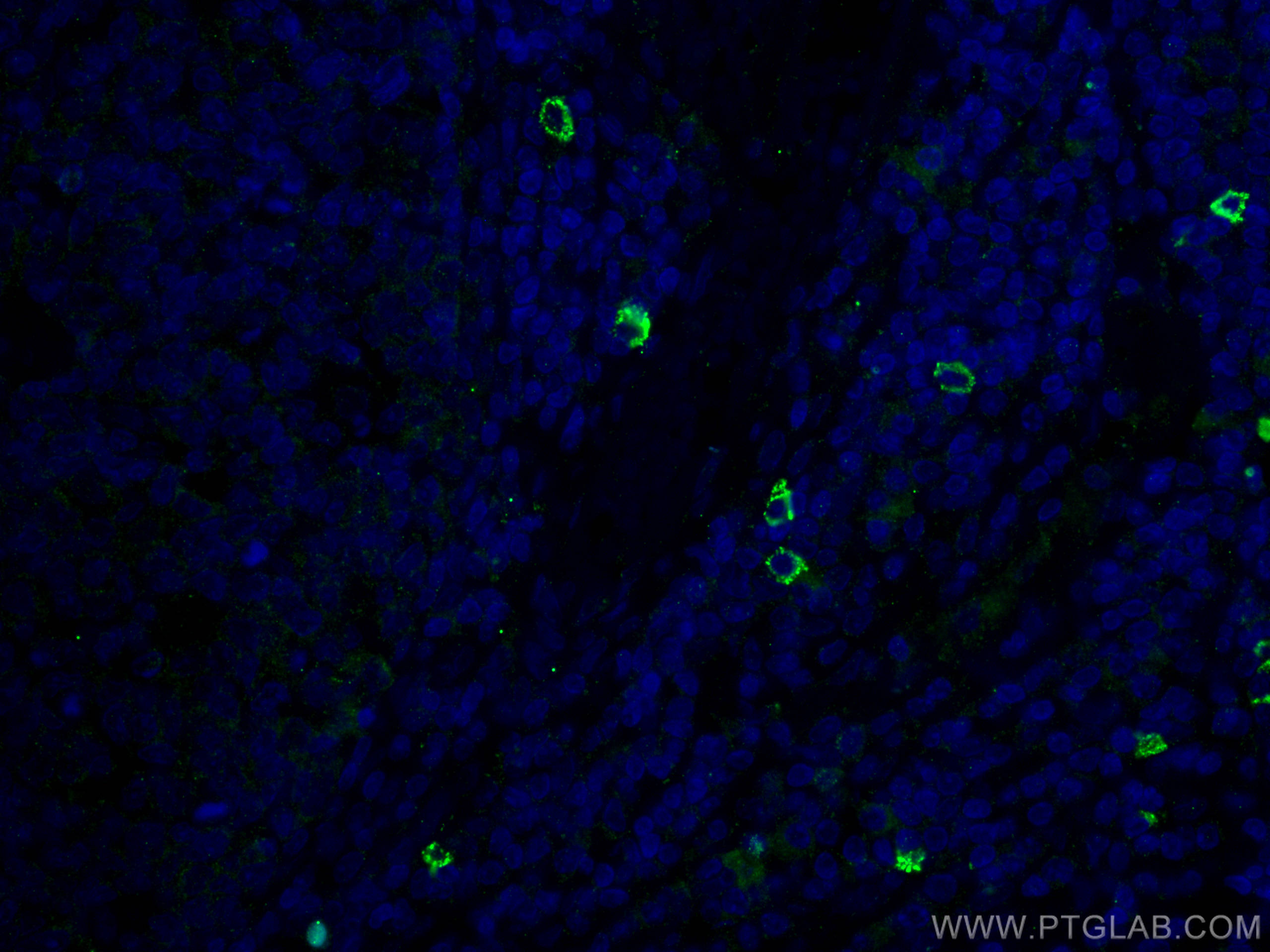 Immunofluorescence (IF) / fluorescent staining of human tonsillitis tissue using TMPRSS2 Polyclonal antibody (14437-1-AP)