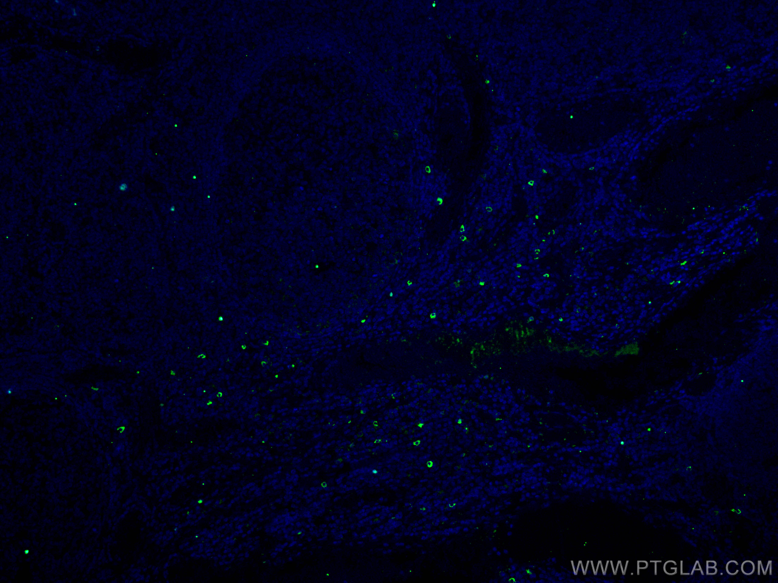 Immunofluorescence (IF) / fluorescent staining of human tonsillitis tissue using TMPRSS2 Polyclonal antibody (14437-1-AP)