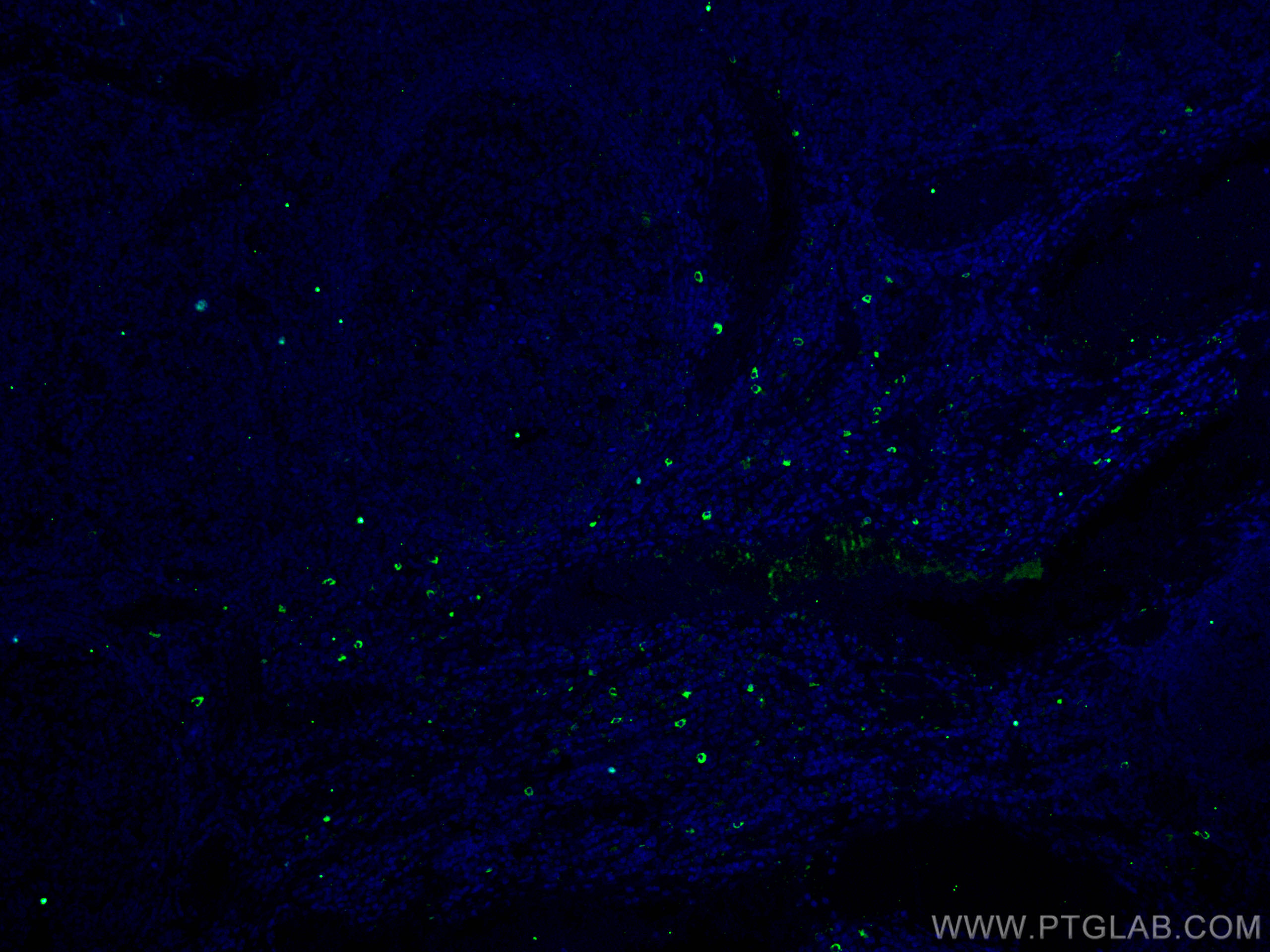 IF Staining of human tonsillitis using 14437-1-AP