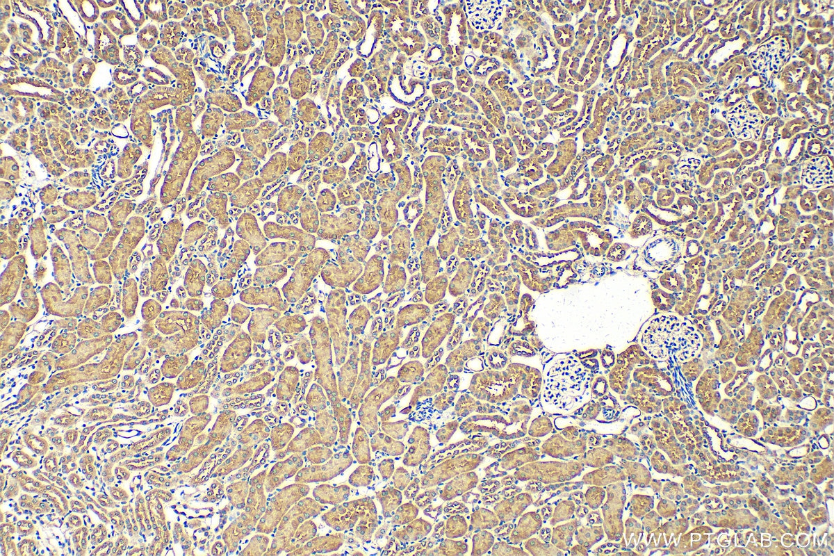 Immunohistochemistry (IHC) staining of mouse kidney tissue using TMPRSS2 Polyclonal antibody (14437-1-AP)