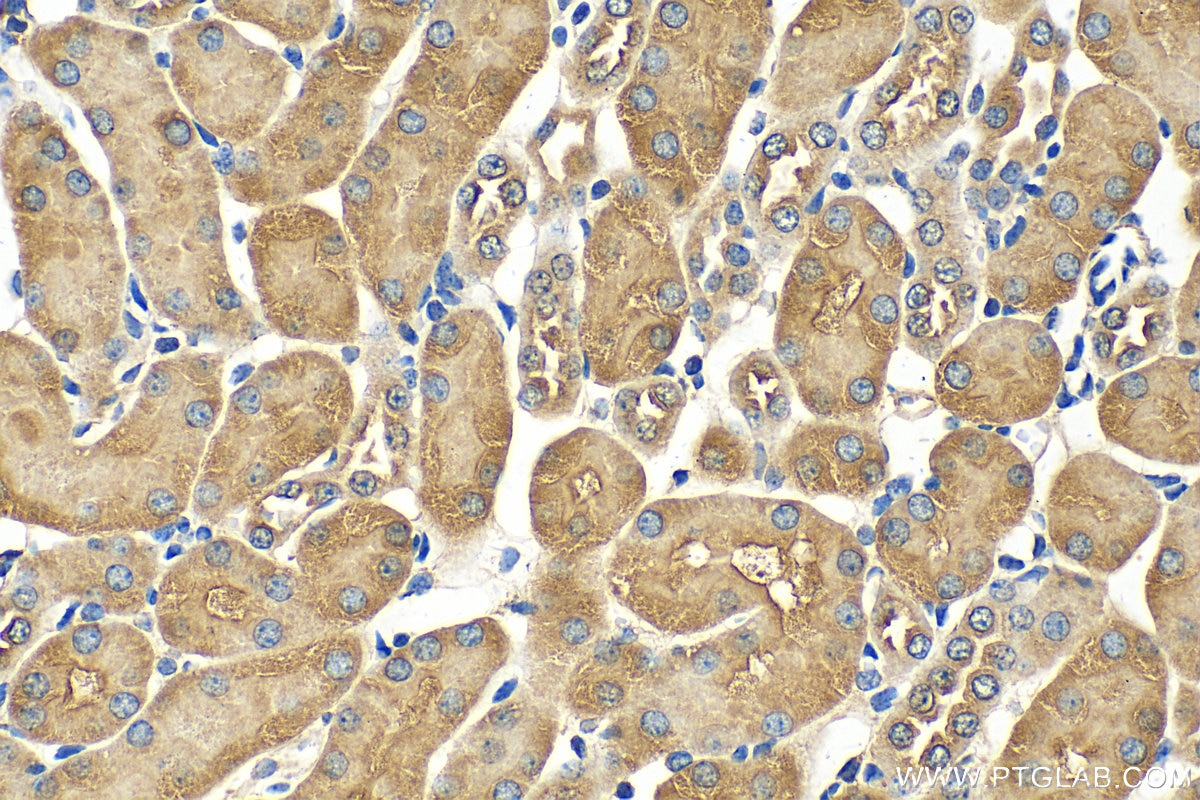 Immunohistochemistry (IHC) staining of mouse kidney tissue using TMPRSS2 Polyclonal antibody (14437-1-AP)