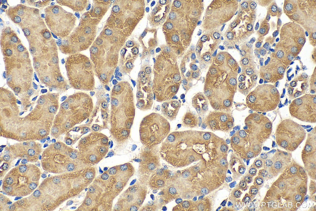 IHC staining of mouse kidney using 14437-1-AP