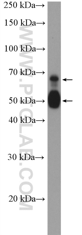 Western Blot (WB) analysis of COLO 320 cells using TMPRSS2 Polyclonal antibody (14437-1-AP)
