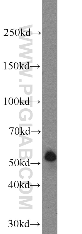 Western Blot (WB) analysis of COLO 320 cells using TMPRSS2 Polyclonal antibody (14437-1-AP)