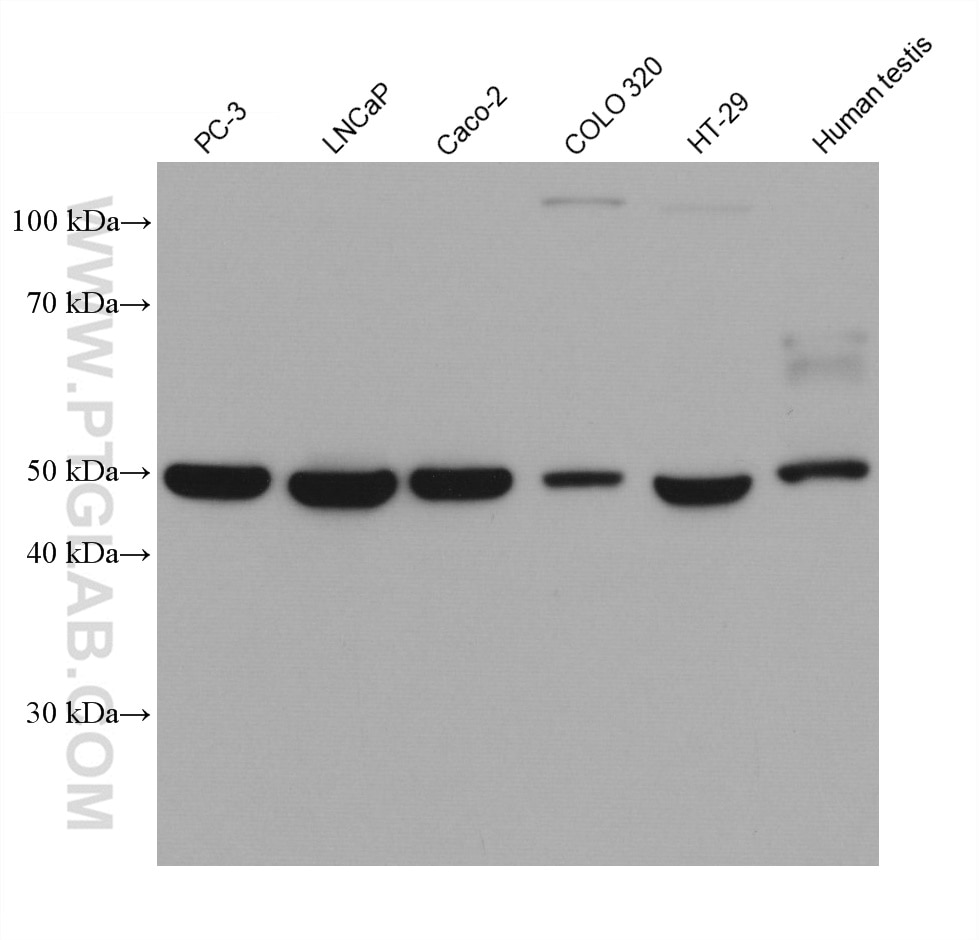 Western Blot (WB) analysis of various lysates using TMPRSS2 Monoclonal antibody (68264-1-Ig)