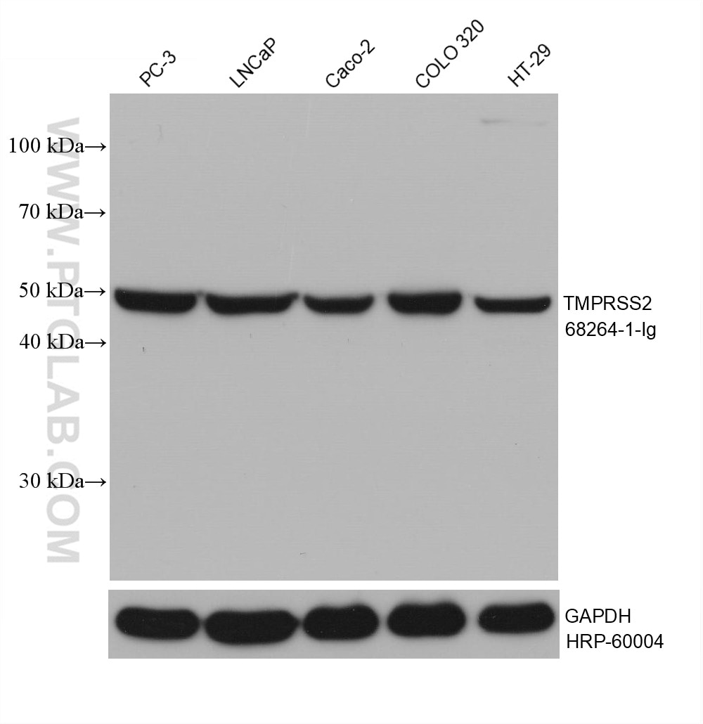 Western Blot (WB) analysis of various lysates using TMPRSS2 Monoclonal antibody (68264-1-Ig)