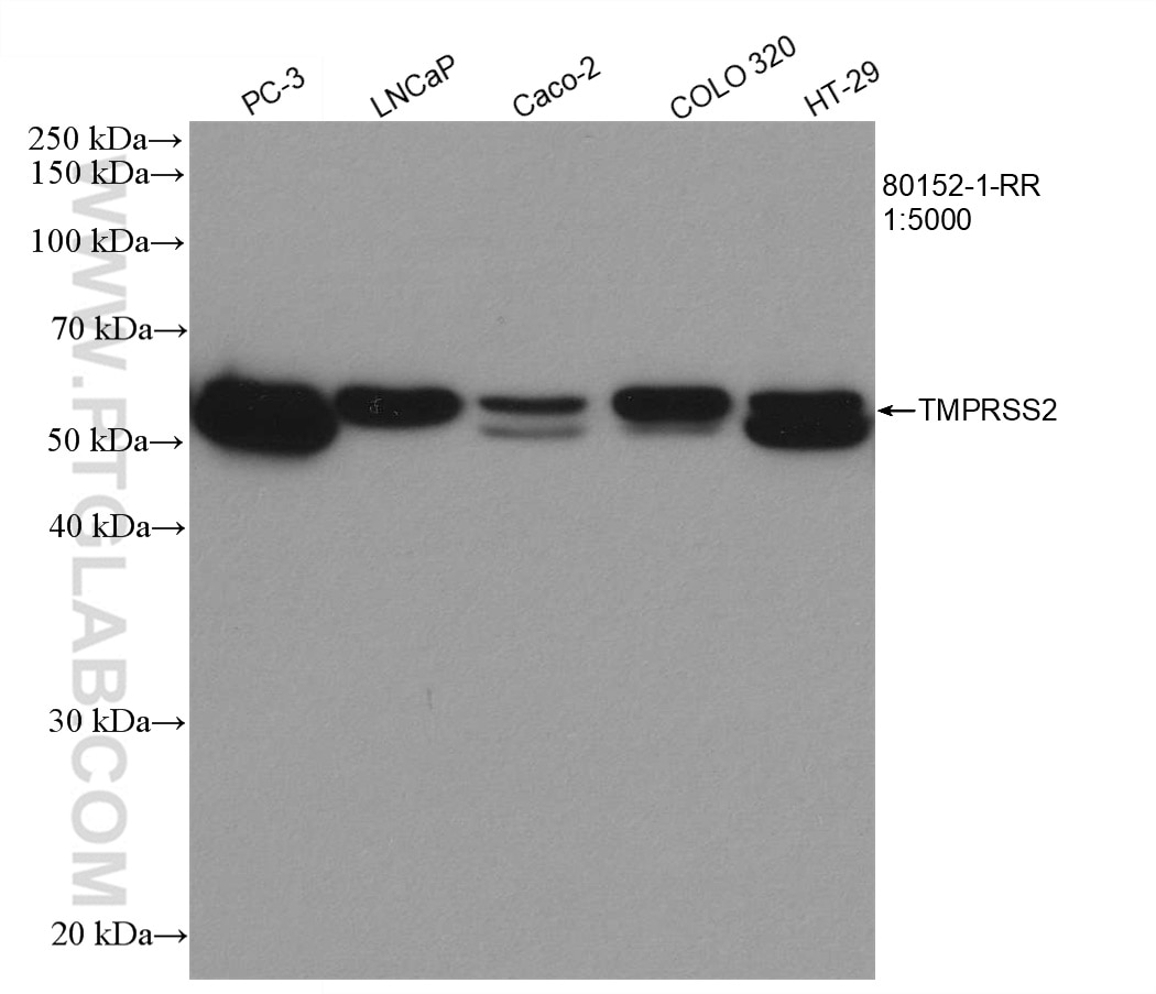 Western Blot (WB) analysis of various lysates using TMPRSS2 Recombinant antibody (80152-1-RR)