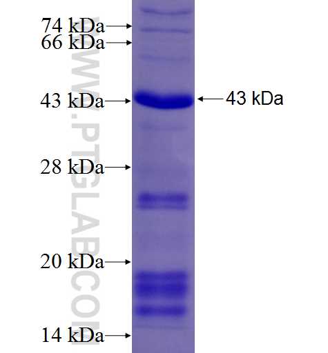 TMPRSS2 fusion protein Ag5824 SDS-PAGE
