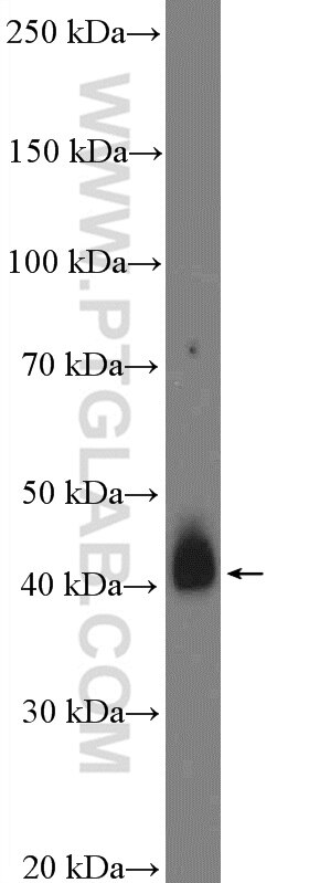 Western Blot (WB) analysis of mouse skin tissue using TMPRSS3 Polyclonal antibody (17953-1-AP)