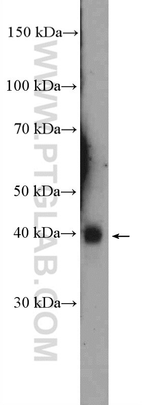 Western Blot (WB) analysis of mouse skin tissue using TMPRSS3 Polyclonal antibody (17953-1-AP)