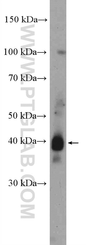 Western Blot (WB) analysis of mouse skin tissue using TMPRSS3 Polyclonal antibody (17953-1-AP)