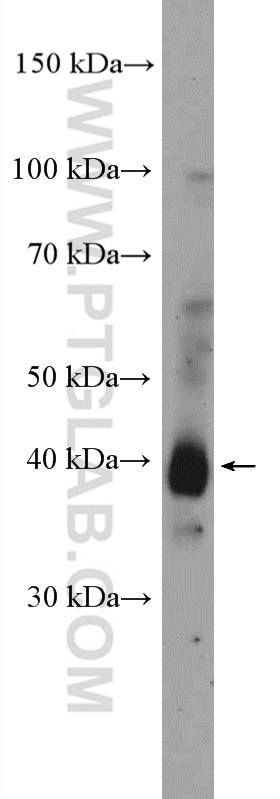 Western Blot (WB) analysis of mouse skin tissue using TMPRSS3 Polyclonal antibody (17953-1-AP)