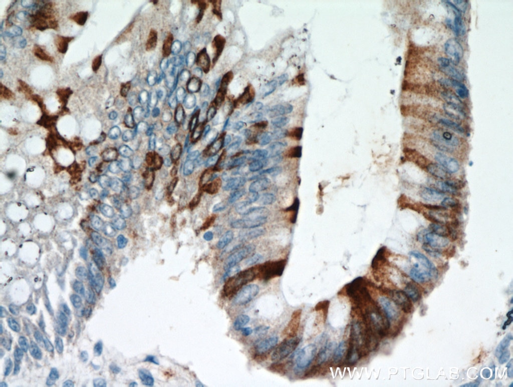 IHC staining of human colon using 11283-1-AP