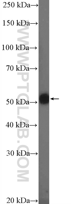 Western Blot (WB) analysis of SW 1990 cells using TMPRSS4 Polyclonal antibody (11283-1-AP)