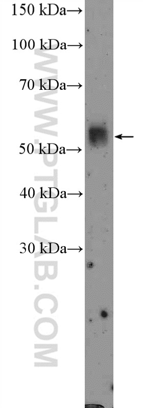 Western Blot (WB) analysis of mouse stomach tissue using TMPRSS4 Polyclonal antibody (11283-1-AP)