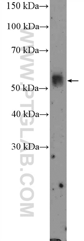 WB analysis of mouse stomach using 11283-1-AP